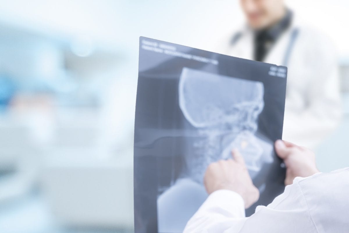 Doctor examining jaw x-rays