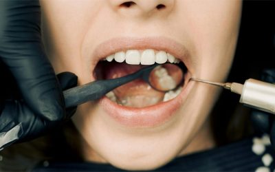 Understanding Gum Disease: Causes, Symptoms, and Prevention